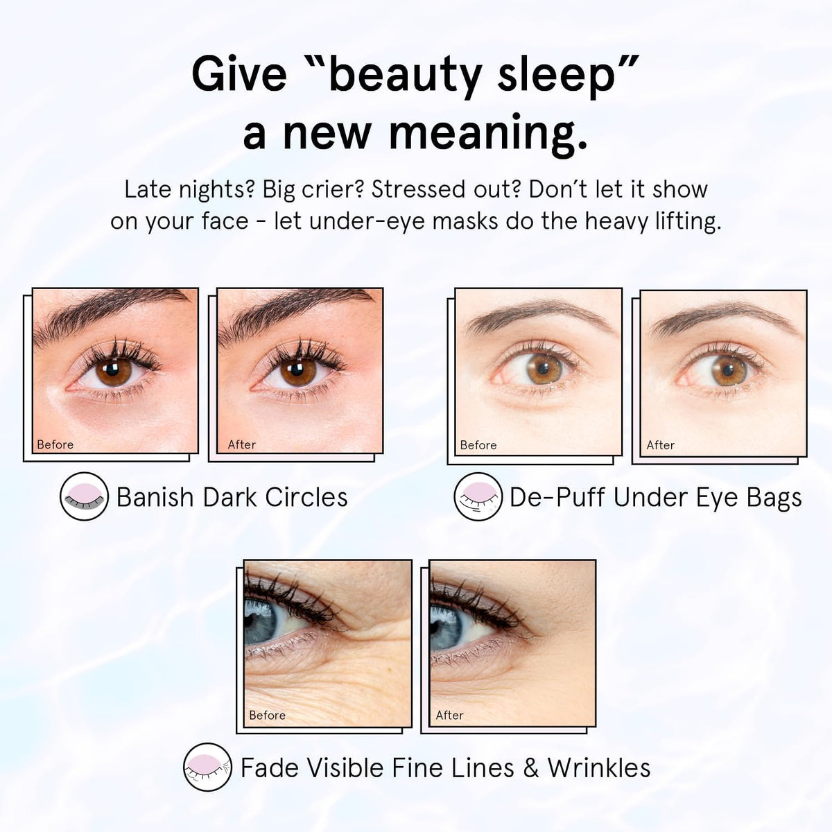 grace & stella Retinol Under Eye Patches for Puffy Eyes & Dark Circles - Restoring Gel Under Eye Masks with Hyaluronic Acid - Bridesmaid Gifts, Birthday Gifts for Women (Purple, 24 Pairs)