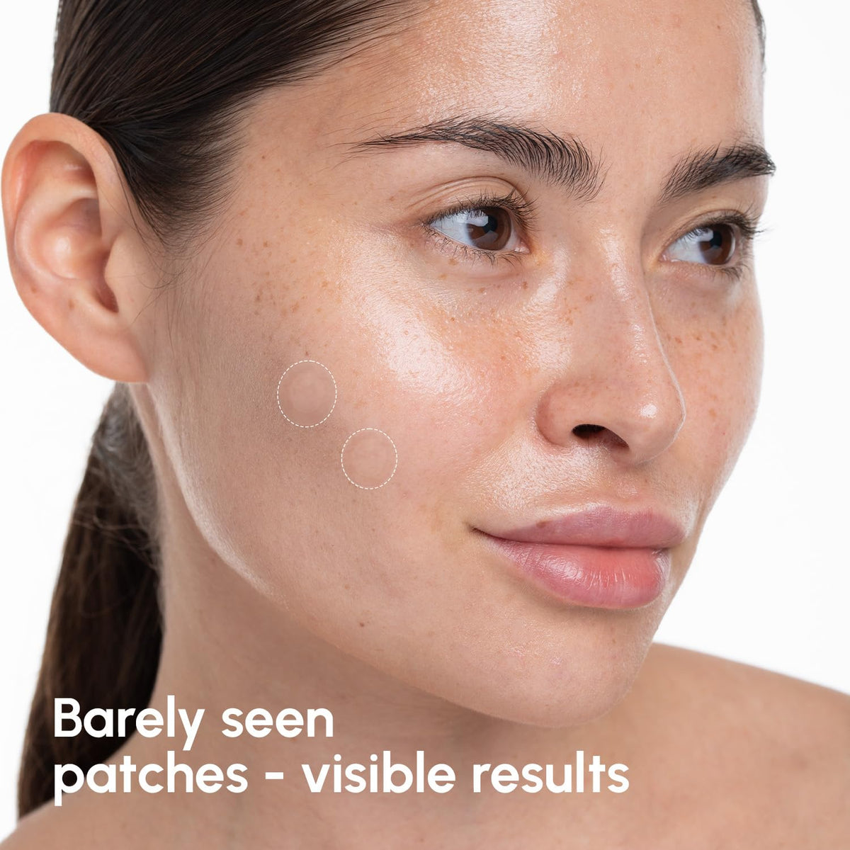 MAREE Invisible Pimple Patches - Clear Pimple Patches for Face - Hydrocolloid Acne Patches Anti Blemish - Zit Stickers for Face - Parches Para Acne - Pinple Zit Patches Pimple Stickers - 72 Dots